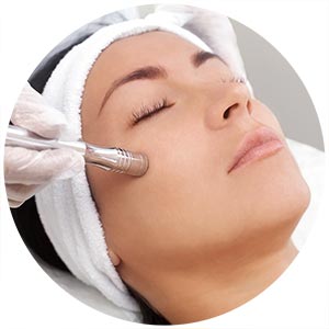 Microdermabrasion