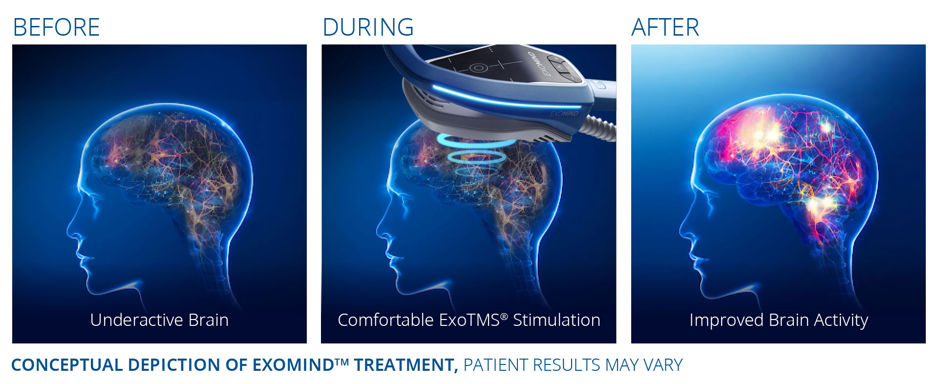 ExoMind Before and After