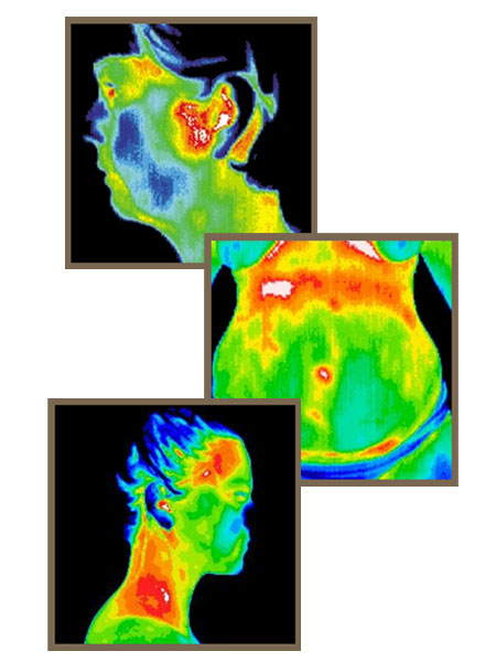 infrared thermal imaging