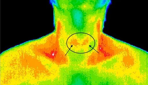 Thermal Imaging